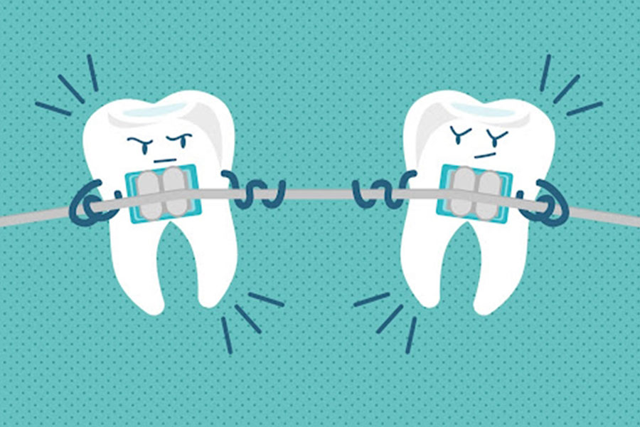 Is Teeth Straightening With Braces Painful?