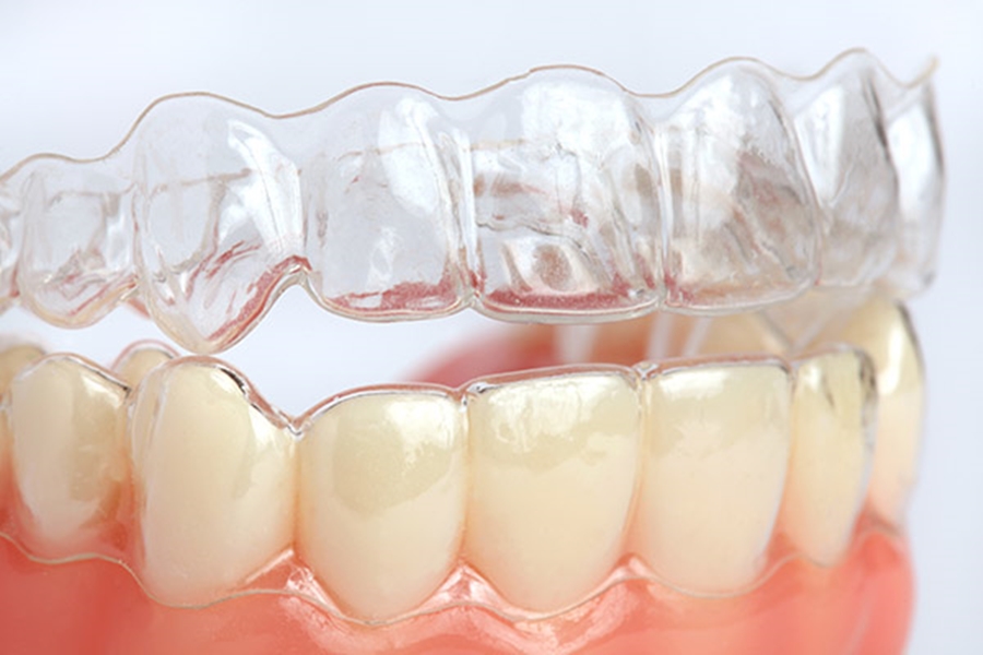 Cheap Teeth Straightening