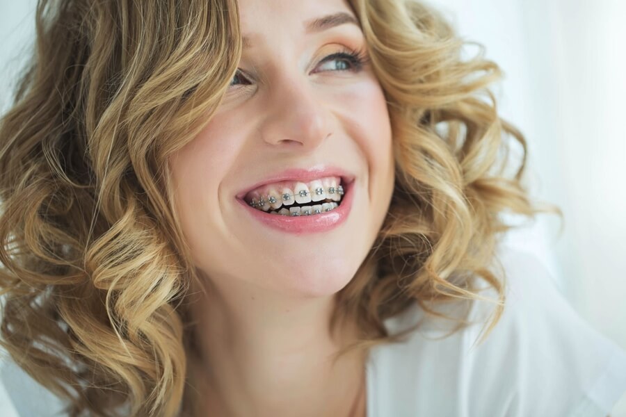 Fix Crooked Teeth