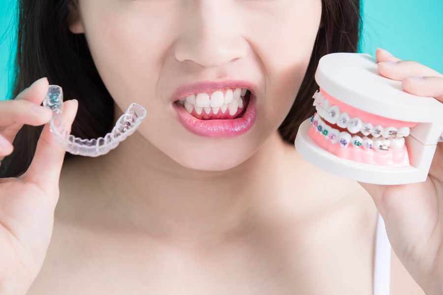 How Much Does Invisalign Cost in New South Wales?