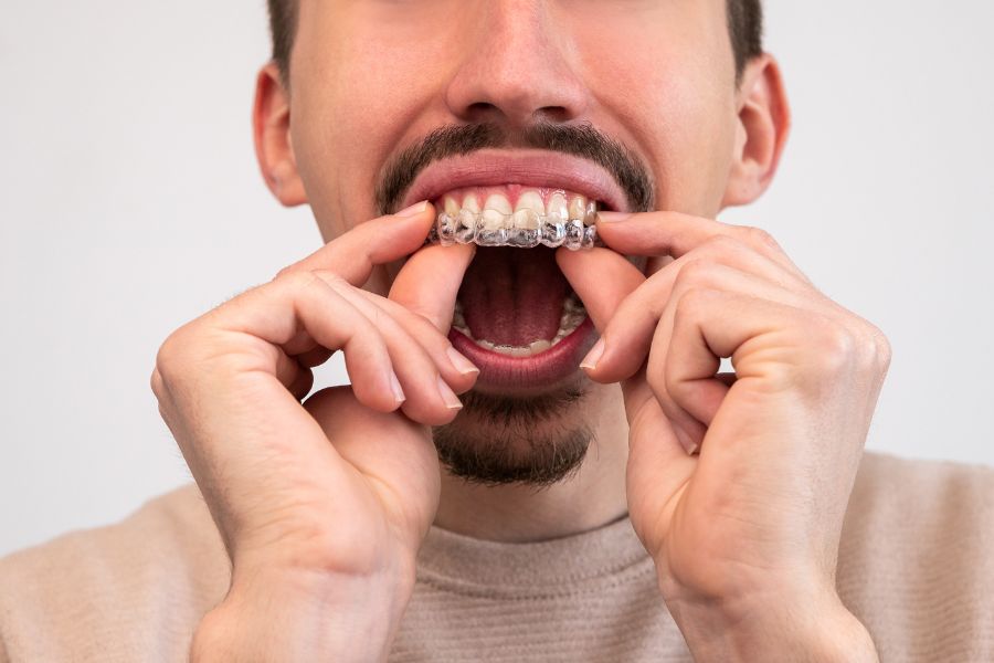 How Much Does Invisalign Cost in Hobart Tasmania?