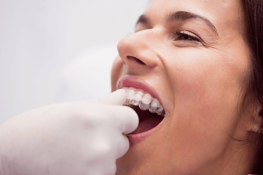 Invisalign Cost in Prince George: A Comprehensive Guide