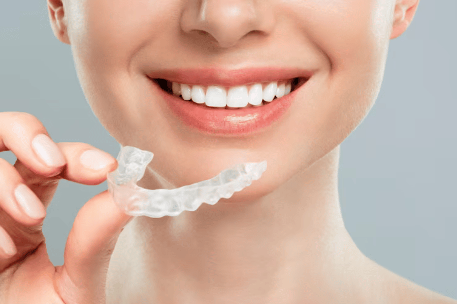 Invisalign Cost in Vermont
