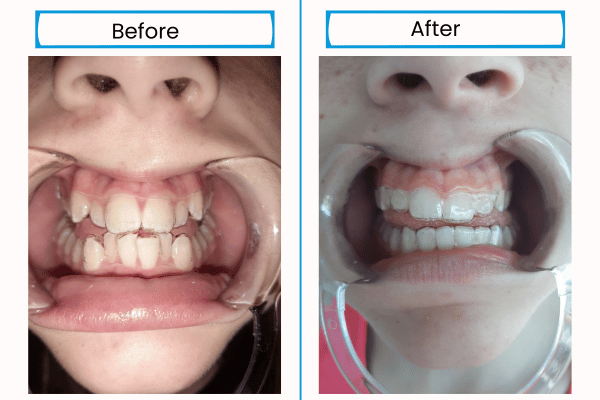 real before and after images
