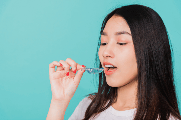  Orthodontic Retainers