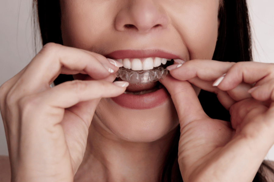 Close-up of woman wearing clear aligners